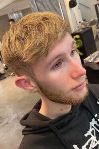 Mens Hair Replacement Services in Nottingham and Loughborough 2